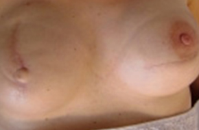 Medische-tatoeage-images-8-voor